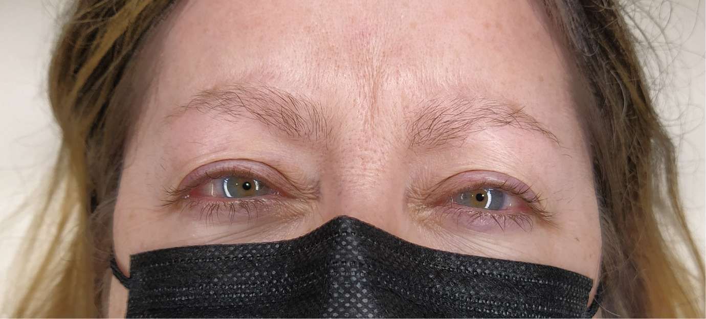 microblading_modelo2_antes