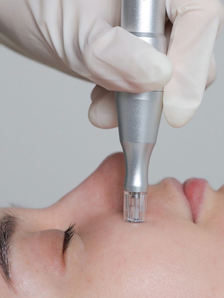 Dermapen con Exosomas
